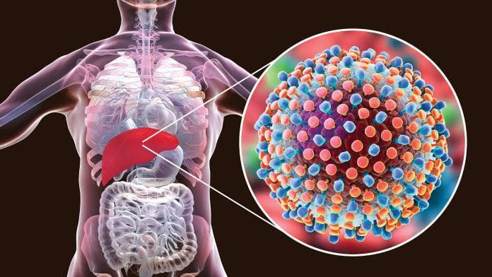 Peligroso y silencioso: Hepatitis “C”; campaña gratuita en puerta