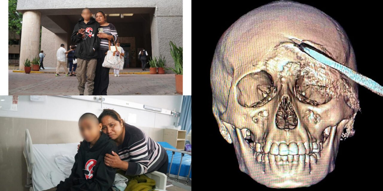 Extraen metal filoso del cráneo de adolescente de Acanceh