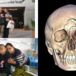 Extraen metal filoso del cráneo de adolescente de Acanceh