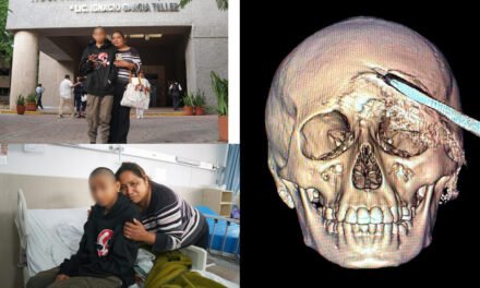 Extraen metal filoso del cráneo de adolescente de Acanceh
