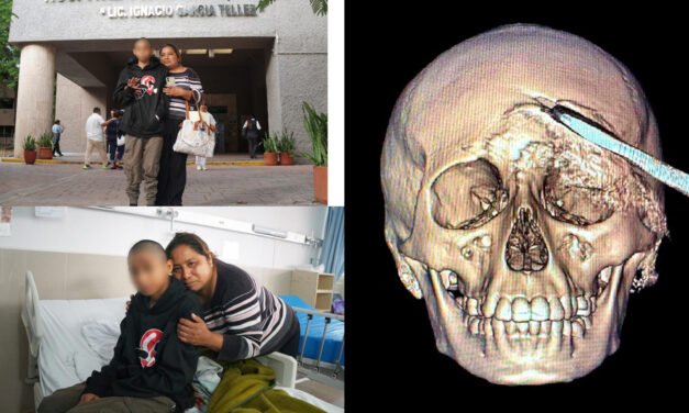 Extraen metal filoso del cráneo de adolescente de Acanceh
