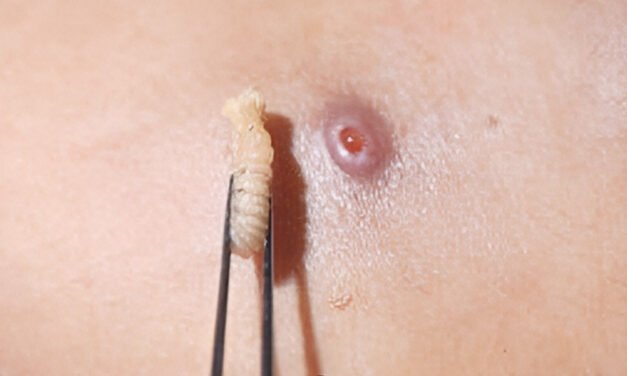 Ocho humanos han sufrido miasis del gusano barrenador en Yucatán