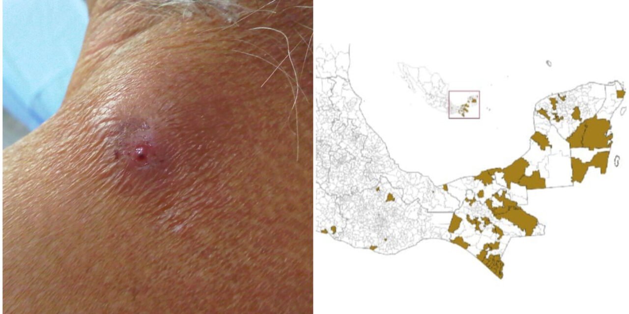 Acumula Yucatán nuevos casos de gusano barrenador en humanos