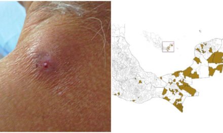 Acumula Yucatán nuevos casos de gusano barrenador en humanos
