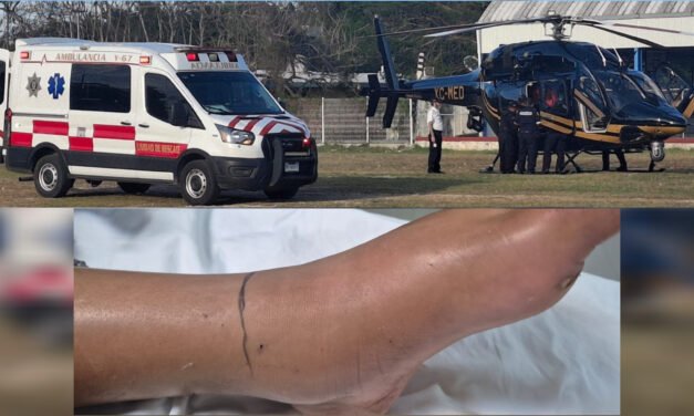 Niña atacada por cascabel en Tizimín lucha por sobrevivir